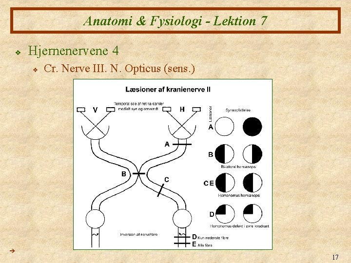 Anatomi & Fysiologi - Lektion 7 v Hjernenervene 4 v Cr. Nerve III. N.