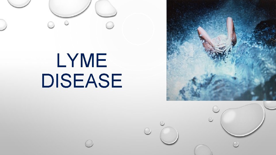 LYME DISEASE 