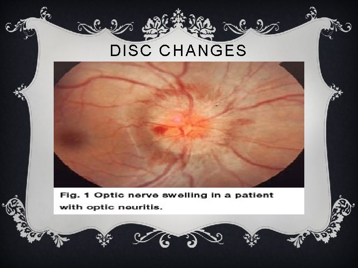 DISC CHANGES DISC CHANGES