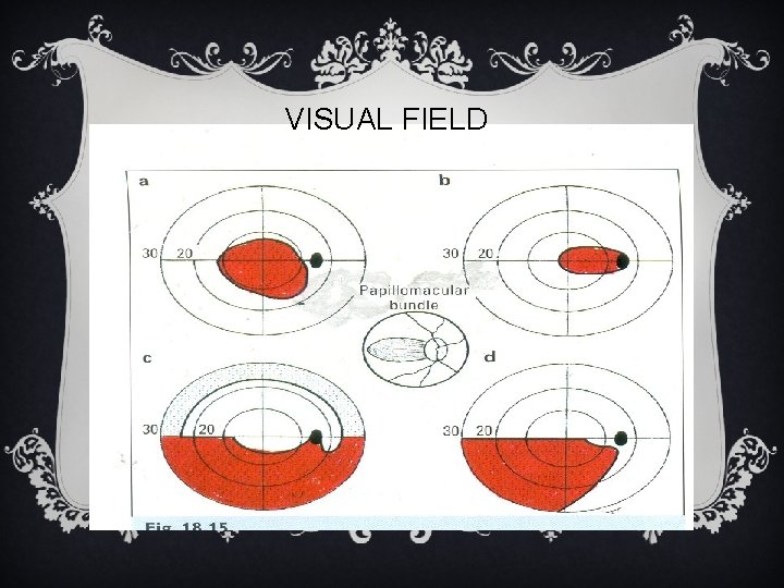VISUAL FIELD VISUAL FIELD