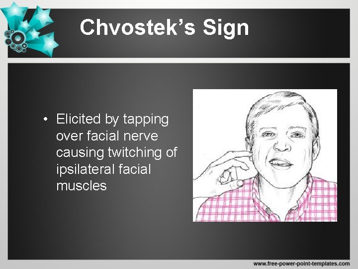 Chvostek’s Sign • Elicited by tapping over facial nerve causing twitching of ipsilateral facial