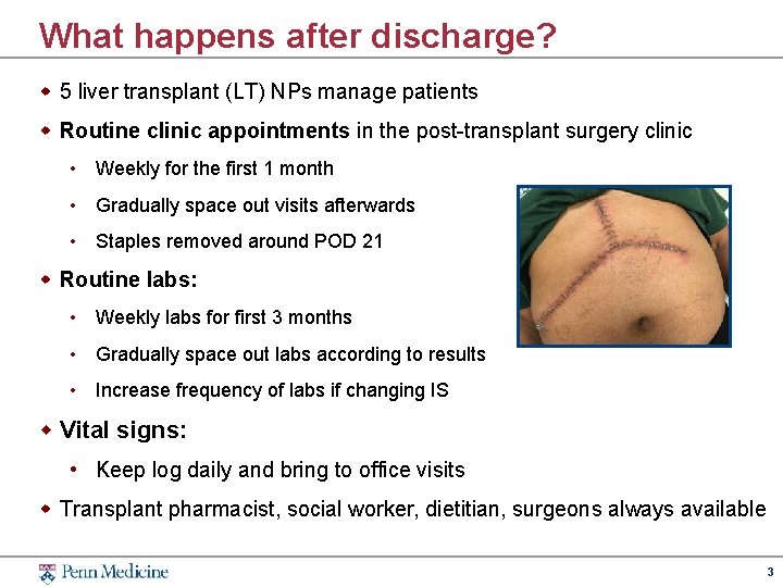 What happens after discharge? w 5 liver transplant (LT) NPs manage patients w Routine