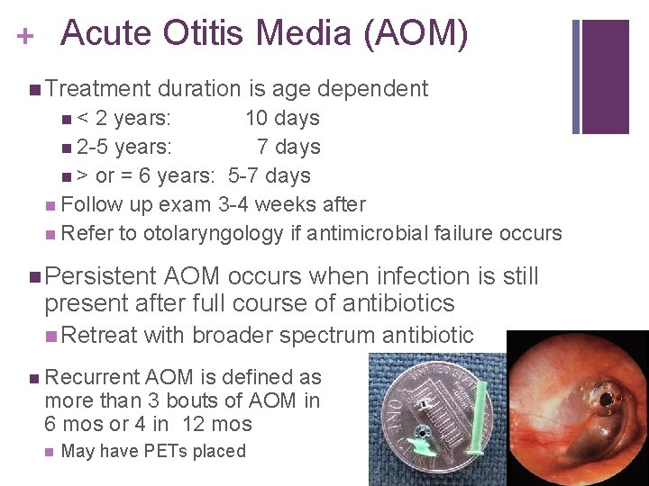 + Acute Otitis Media (AOM) Treatment duration is age dependent < 2 years: 10