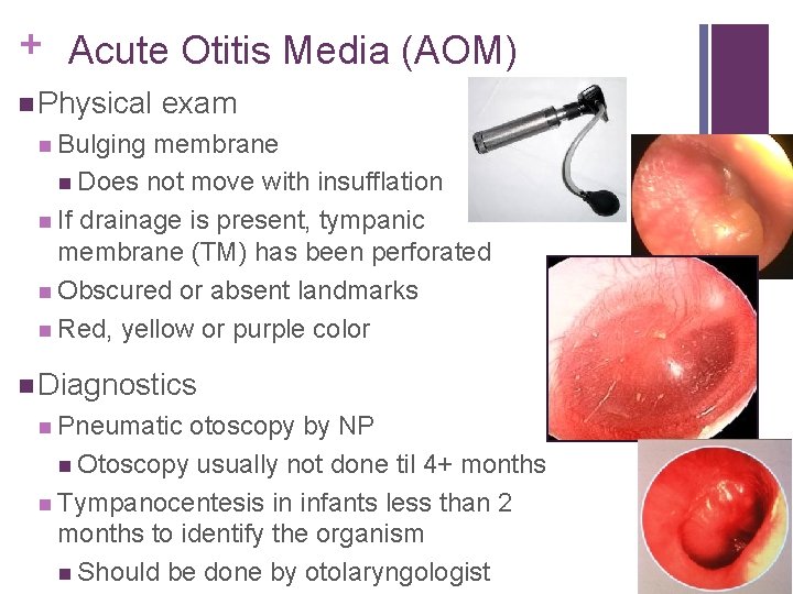 + Acute Otitis Media (AOM) Physical exam Bulging membrane Does not move with insufflation