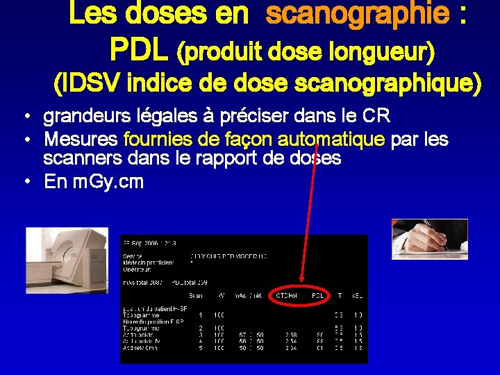Les doses en scanographie : PDL (produit dose longueur) (IDSV indice de dose scanographique)