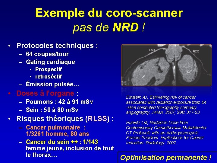 Exemple du coro-scanner pas de NRD ! • Protocoles techniques : – 64 coupes/tour
