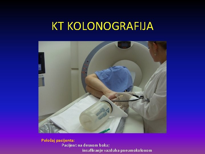 KT KOLONOGRAFIJA Položaj pacijenta: Pacijent na desnom boku; insufliranje vazduha pneumokolonom 
