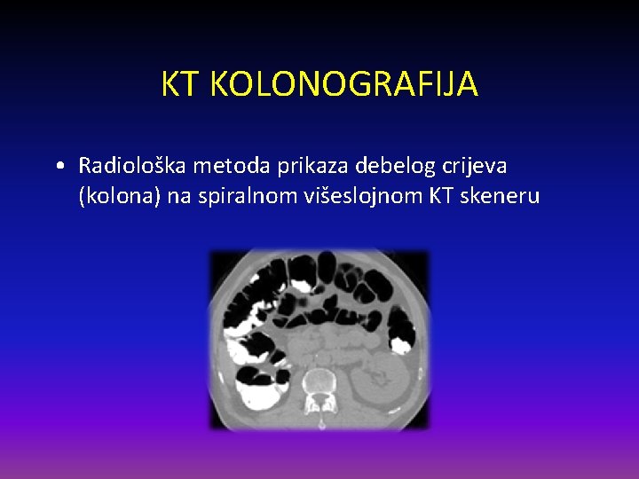 KT KOLONOGRAFIJA • Radiološka metoda prikaza debelog crijeva (kolona) na spiralnom višeslojnom KT skeneru