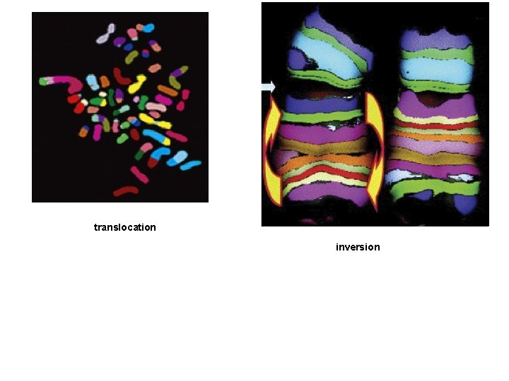 translocation inversion 