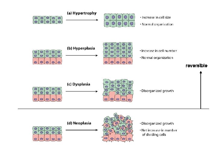 reversible 