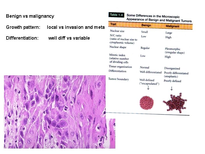 Benign vs malignancy Growth pattern: local vs invasion and meta Differentiation: well diff vs