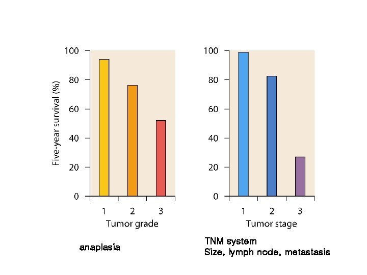 anaplasia TNM system Size, lymph node, metastasis 