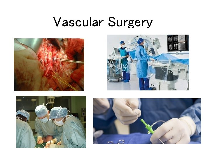 Vascular Surgery 