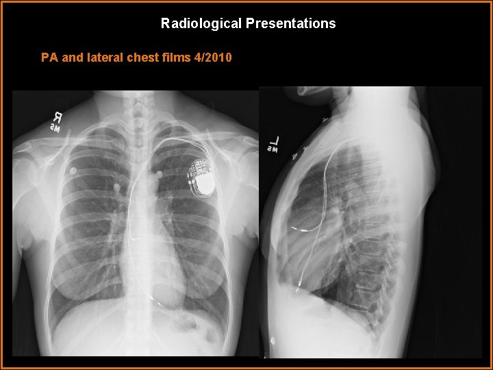 Radiological Presentations PA and lateral chest films 4/2010 