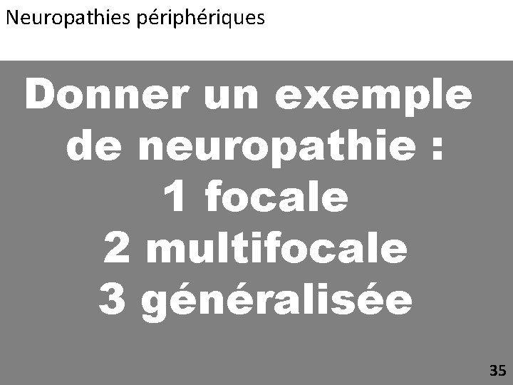 Neuropathies périphériques Donner un exemple de neuropathie : 1 focale 2 multifocale 3 généralisée