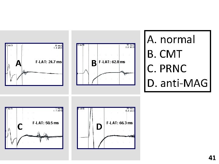 A C F-LAT: 24. 7 ms F-LAT: 50. 5 ms B F-LAT: 62. 8