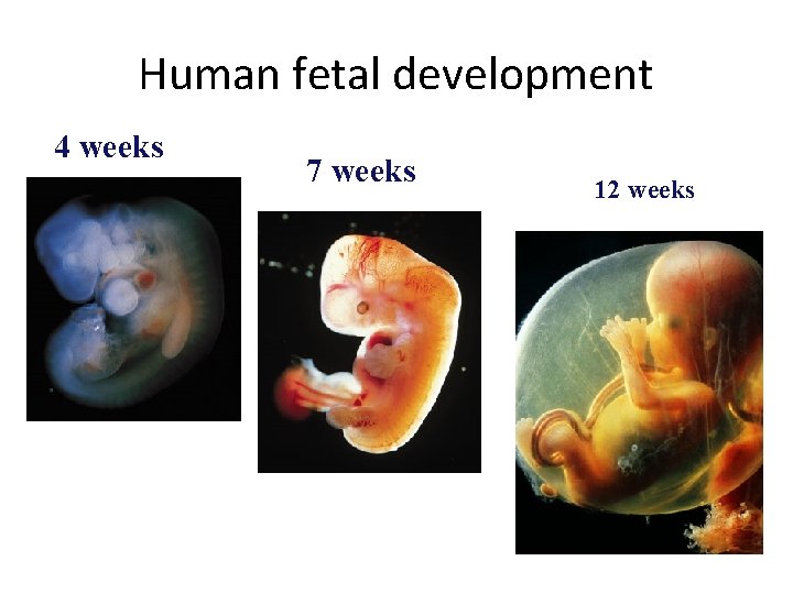 Human fetal development 4 weeks 7 weeks 12 weeks Human fetal development 4 weeks 7 weeks 12 weeks