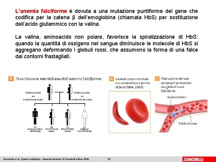 L’anemia falciforme è dovuta a una mutazione puntiforme del gene che codifica per la