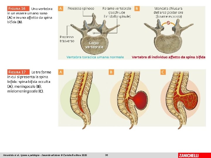 Amendola et al. , Igiene e patologia - Seconda edizione © Zanichelli editore 2020