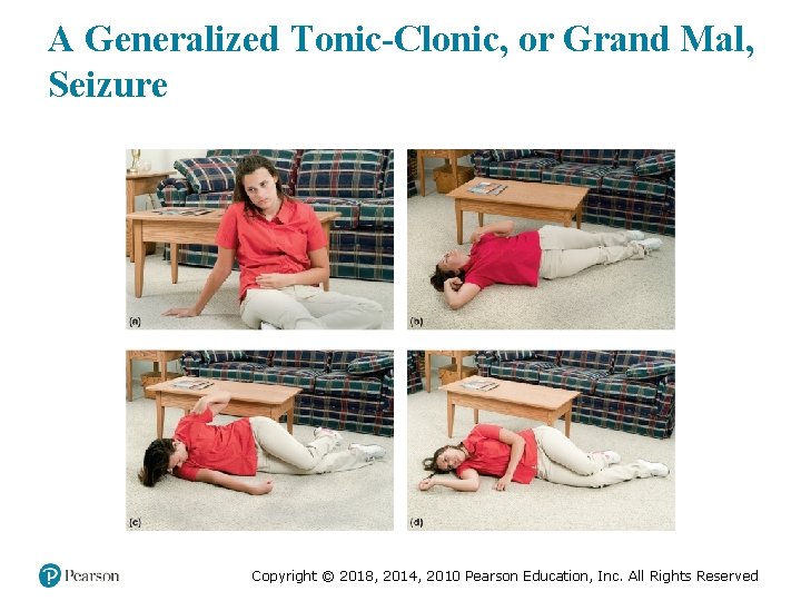 A Generalized Tonic-Clonic, or Grand Mal, Seizure Copyright © 2018, 2014, 2010 Pearson Education,