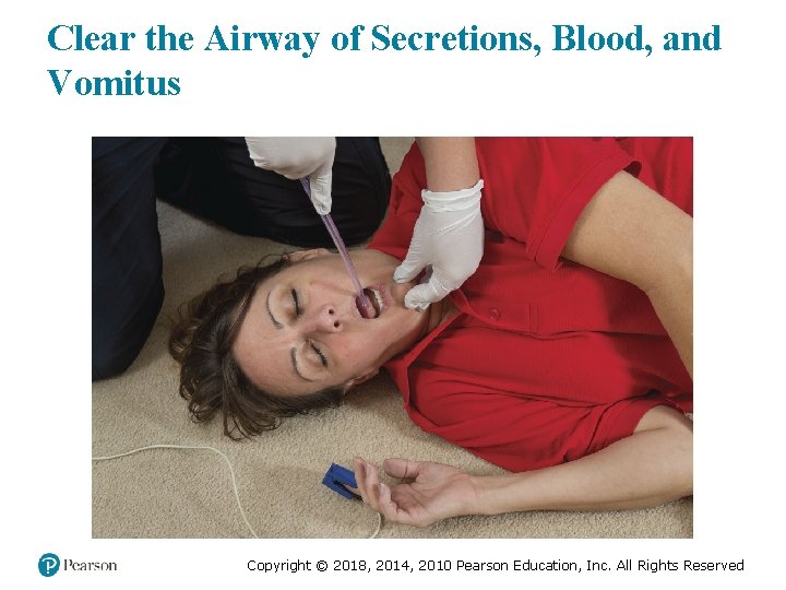 Clear the Airway of Secretions, Blood, and Vomitus Copyright © 2018, 2014, 2010 Pearson