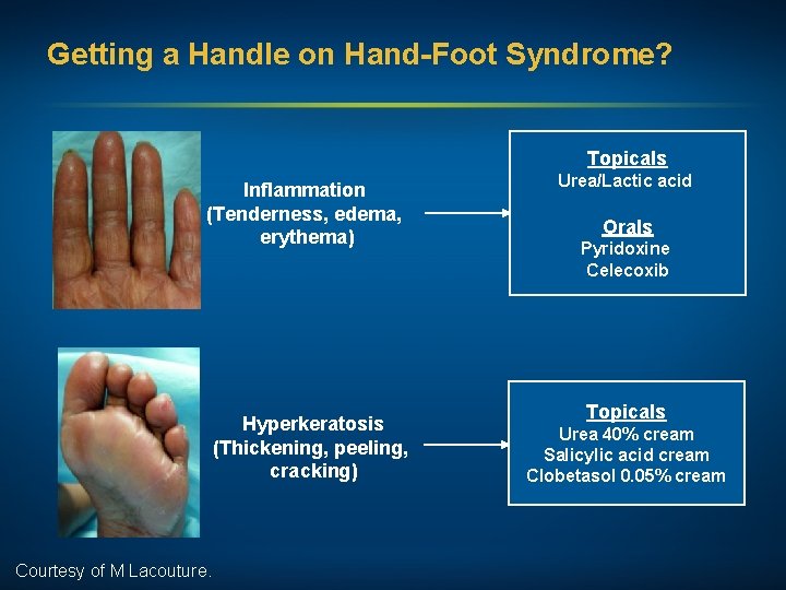 Getting a Handle on Hand-Foot Syndrome? Topicals Inflammation (Tenderness, edema, erythema) Hyperkeratosis (Thickening, peeling,