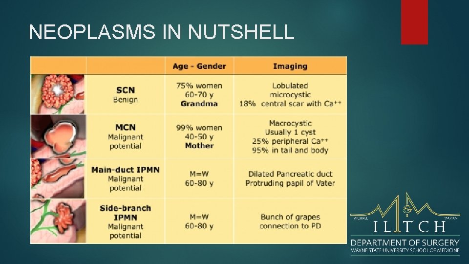 NEOPLASMS IN NUTSHELL 
