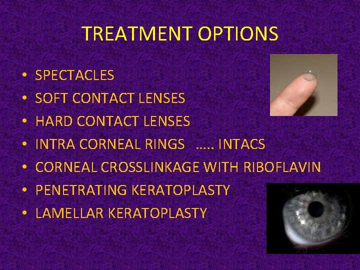 TREATMENT OPTIONS • • SPECTACLES SOFT CONTACT LENSES HARD CONTACT LENSES INTRA CORNEAL RINGS
