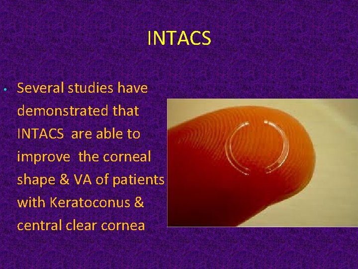 INTACS • Several studies have demonstrated that INTACS are able to improve the corneal