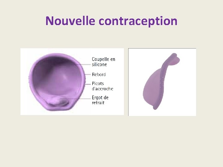 Nouvelle contraception 