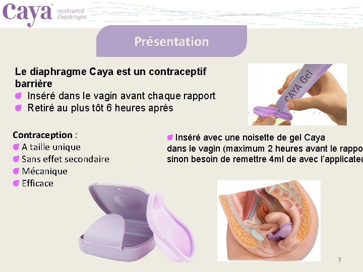 Présentation Le diaphragme Caya est un contraceptif barrière Inséré dans le vagin avant chaque