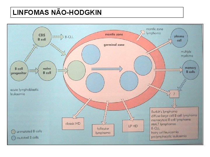 LINFOMAS NÃO-HODGKIN 