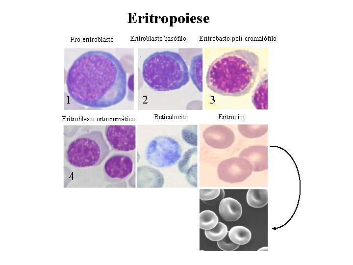 Eritropoiese Pro-eritroblasto Eritroblasto basófilo 1 Eritroblasto ortocromático 4 2 Eritrobasto poli-cromatófilo 3 Reticulocito Eritrocito