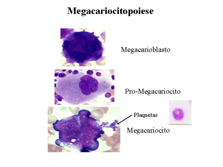Megacariocitopoiese Megacarioblasto Pro-Megacariocito Plaquetas Megacariocito 