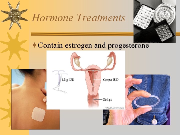 Hormone Treatments ¬Contain estrogen and progesterone 