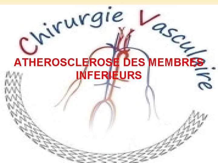 ATHEROSCLEROSE DES MEMBRES INFERIEURS 