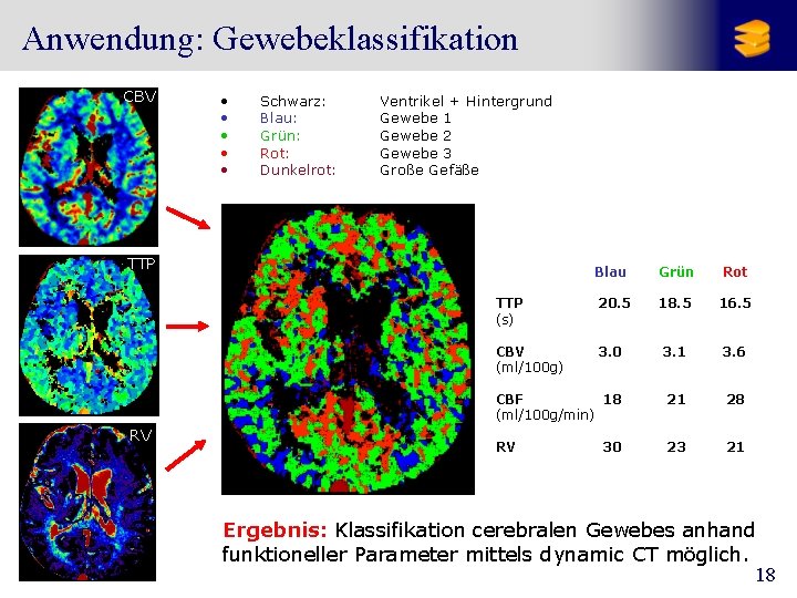 Anwendung: Gewebeklassifikation CBV • • • Schwarz: Blau: Grün: Rot: Dunkelrot: Ventrikel + Hintergrund