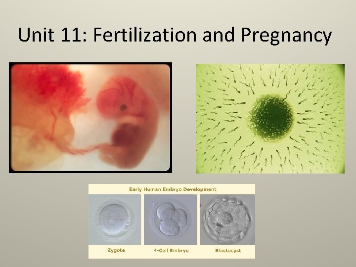 Unit 11: Fertilization and Pregnancy 