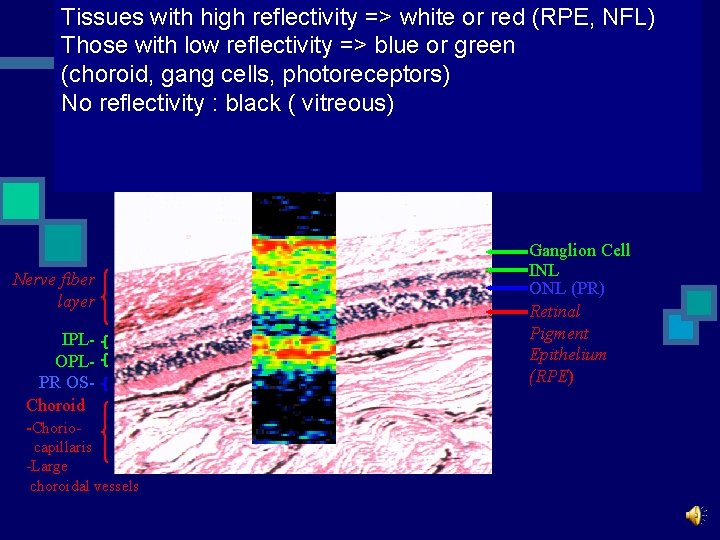 Tissues with high reflectivity => white or red (RPE, NFL) Those with low reflectivity