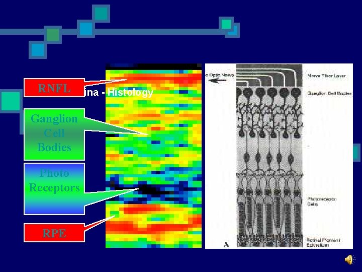 RNFLRetina - Histology Ganglion Cell Bodies Photo Receptors RPE 