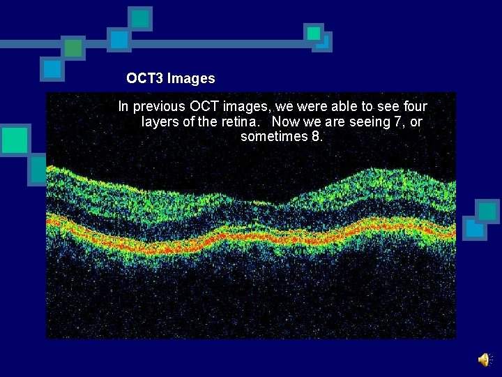 OCT 3 Images In previous OCT images, we were able to see four layers