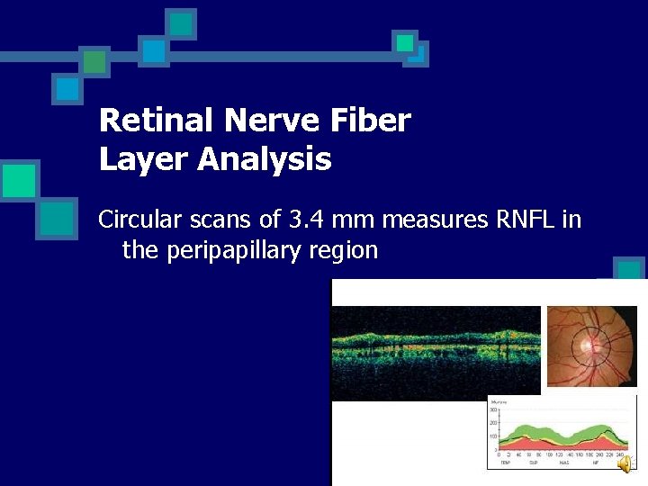 Retinal Nerve Fiber Layer Analysis Circular scans of 3. 4 mm measures RNFL in