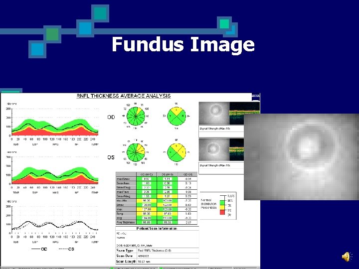 Fundus Image To verify scan placement. n 