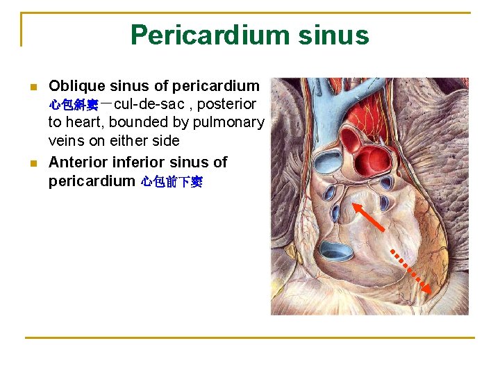 Pericardium sinus n n Oblique sinus of pericardium 心包斜窦－cul-de-sac , posterior to heart, bounded