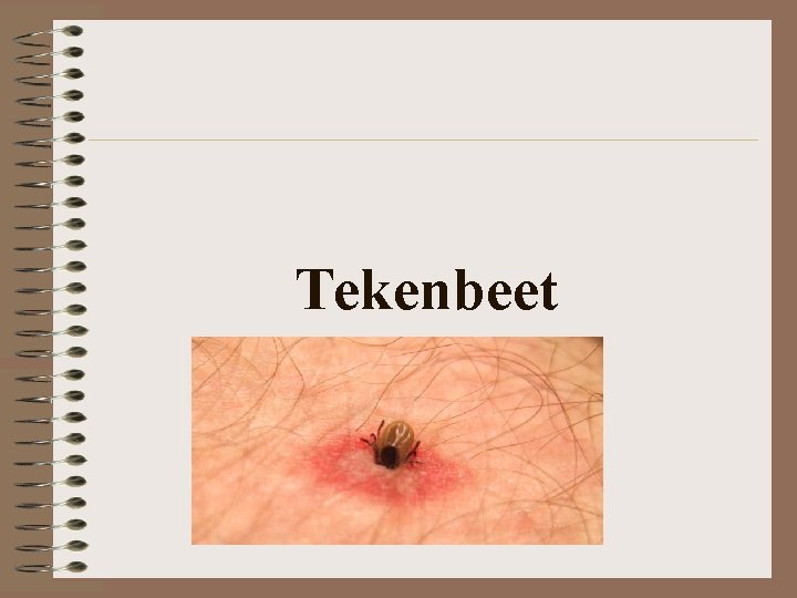 Tekenbeet 