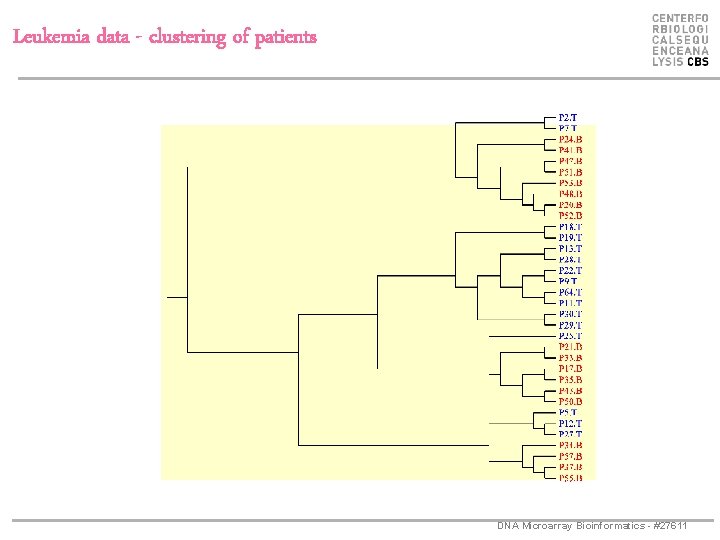 Leukemia data - clustering of patients DNA Microarray Bioinformatics - #27611 