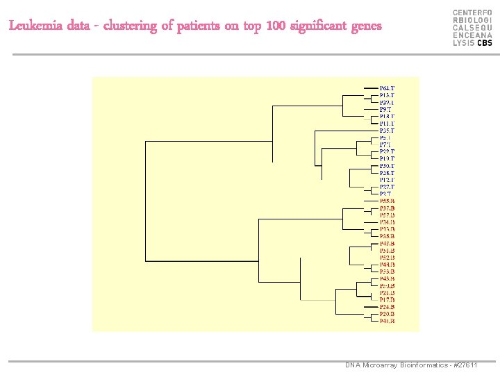 Leukemia data - clustering of patients on top 100 significant genes DNA Microarray Bioinformatics