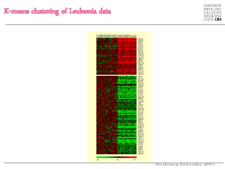 K-means clustering of Leukemia data DNA Microarray Bioinformatics - #27611 
