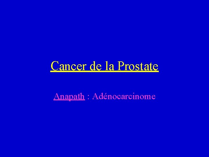Cancer de la Prostate Anapath : Adénocarcinome 
