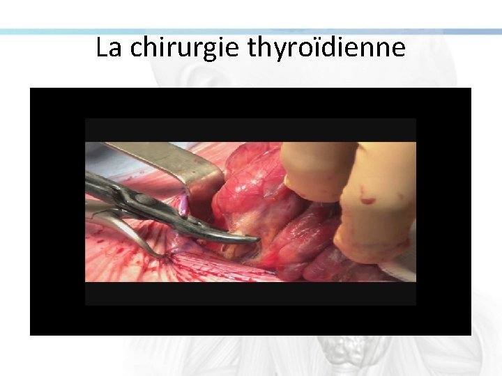 La chirurgie thyroïdienne 